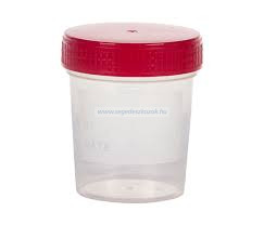 Vizeletes pohár, csavaros fedéllel, műanyag 100 ml  /steril/
